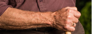 essential oils for the skin - man arm
